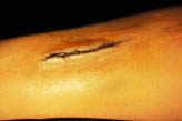 fake wound